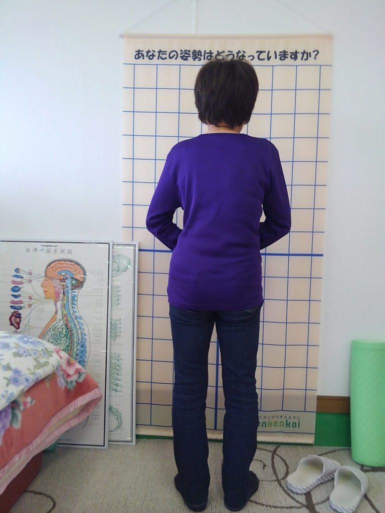 椎間板ヘルニアの患者様